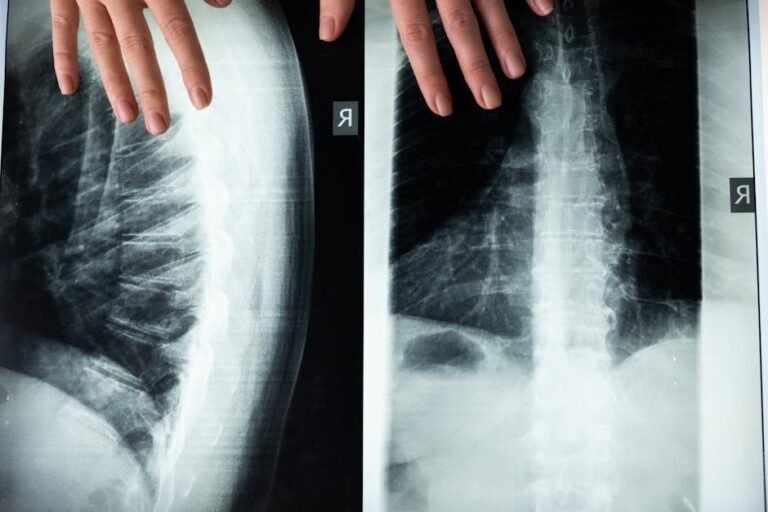 Your Spine’s Secret Support System: Why Deep Stabilizer Muscles Are the Key to Lasting Back Health