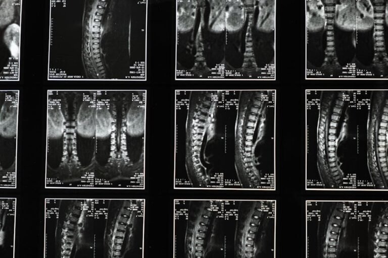 How to Strengthen Hip Muscles to Support the Spine: A Gentle Guide for Older Adults