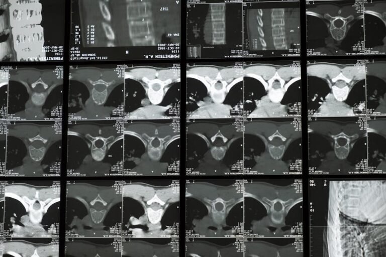 AI and Precision Medicine Are Changing How We Diagnose and Treat Spinal Dysfunction — Here’s What You Need to Know