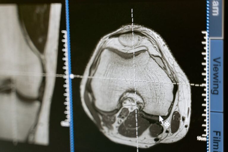 MRI, Ultrasound, and EMG for Back Pain: How Advanced Spine Imaging Guides Personalized Treatment